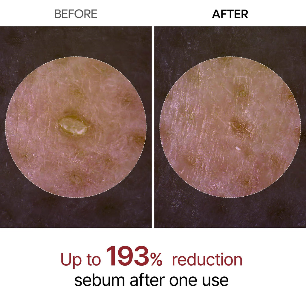 Dr. Melaxin Peel Shot Kojic Acid Turmeric Serum – Exfoliating Dark Spot Corrector with AHA/BHA & Niacinamide, Brightening & Even Tone Facial Serum (80ml / 2.70 fl oz)