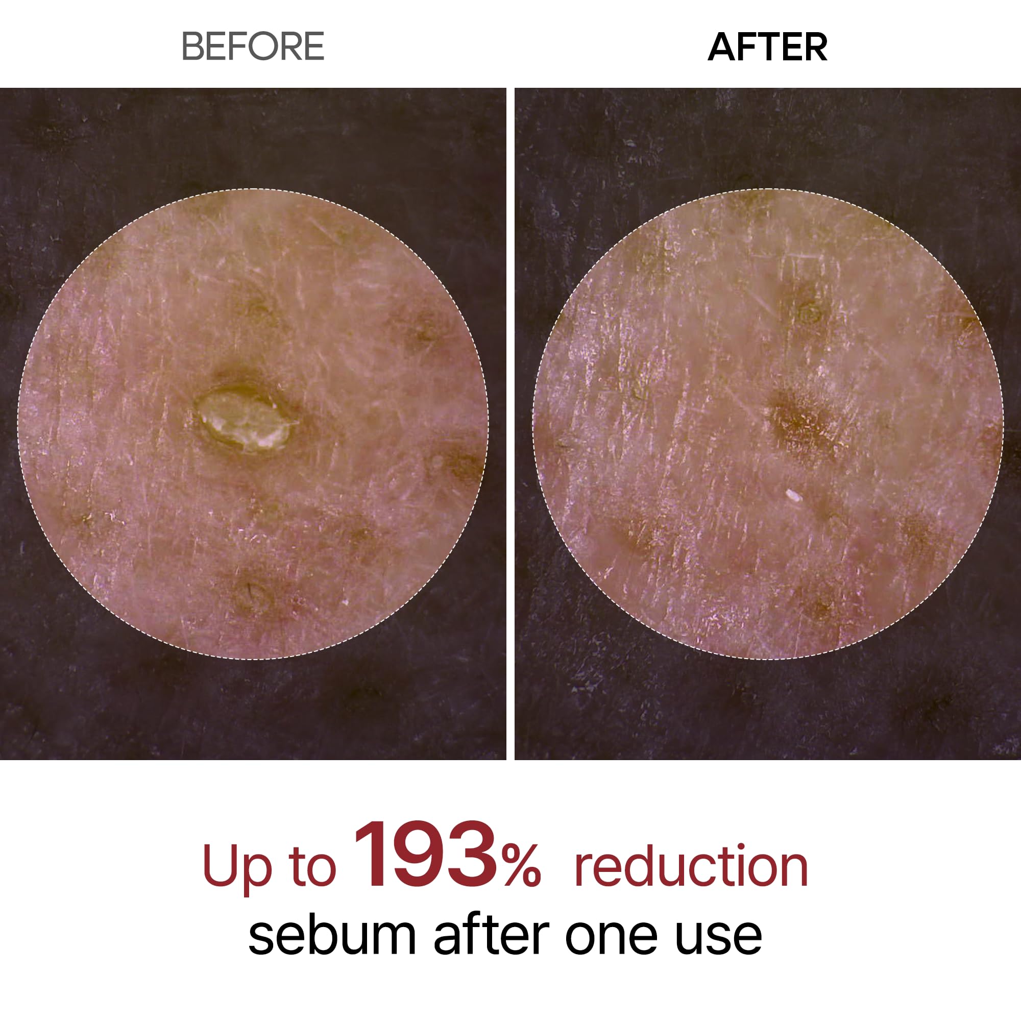 Dr. Melaxin Peel Shot Kojic Acid Turmeric Serum – Exfoliating Dark Spot Corrector with AHA/BHA & Niacinamide, Brightening & Even Tone Facial Serum (80ml / 2.70 fl oz)