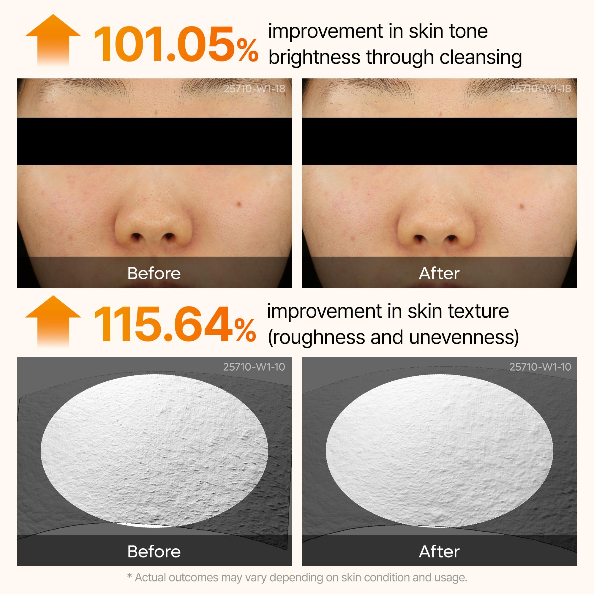 Dr. Melaxin Peel Shot Kojic Acid Turmeric Serum – Exfoliating Dark Spot Corrector with AHA/BHA & Niacinamide, Brightening & Even Tone Facial Serum (80ml / 2.70 fl oz)